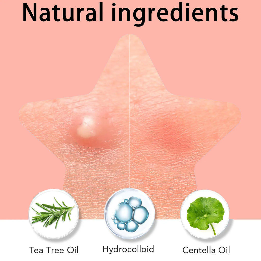 1008/504 pieces/box of acne patches, non irritating acne stickers, high-quality salicylic acid and tea tree oil acne patches