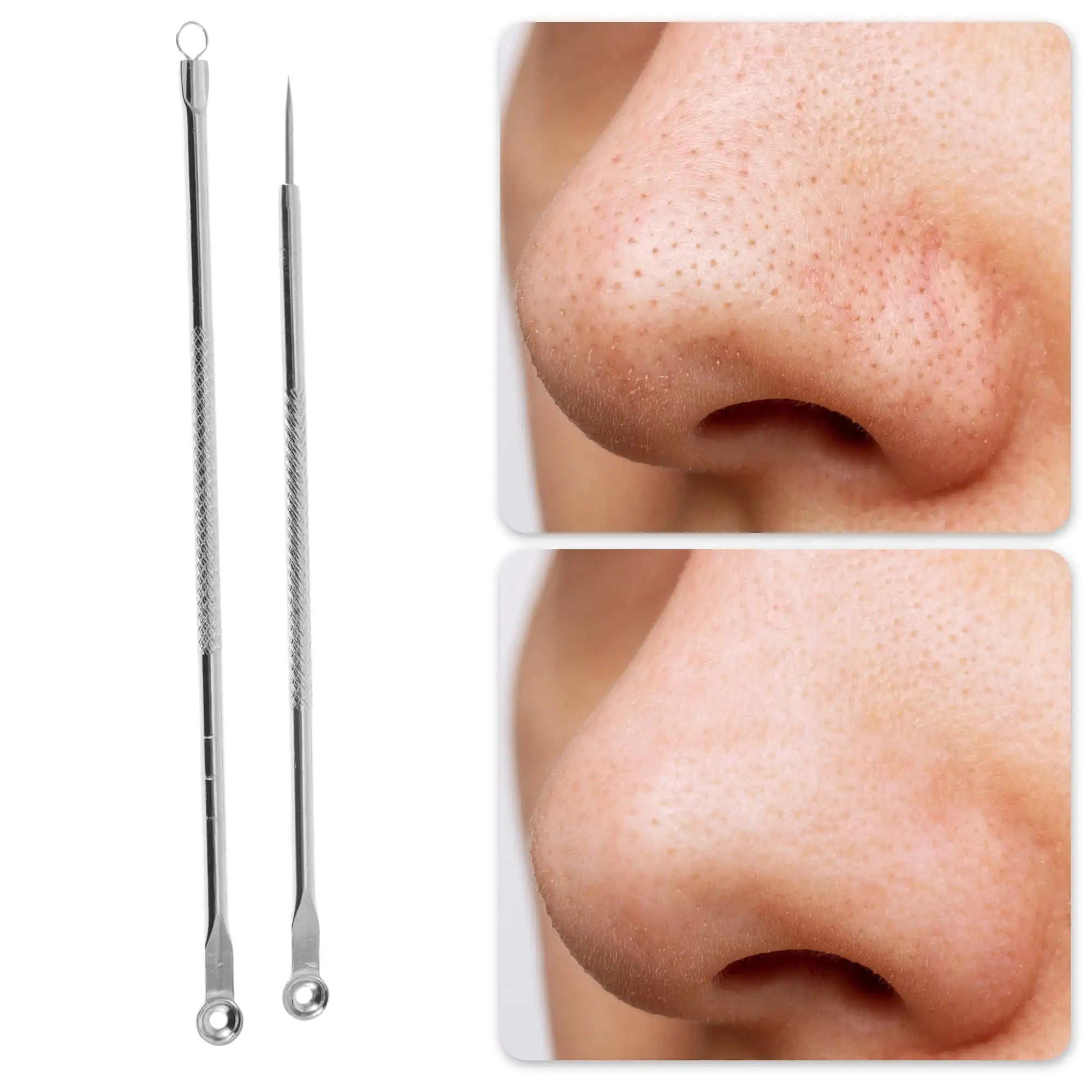 Professional Durable Pimple Extractor Tool Kit Silver Tone Blackhead Remover Acne Comedone Extraction Set
