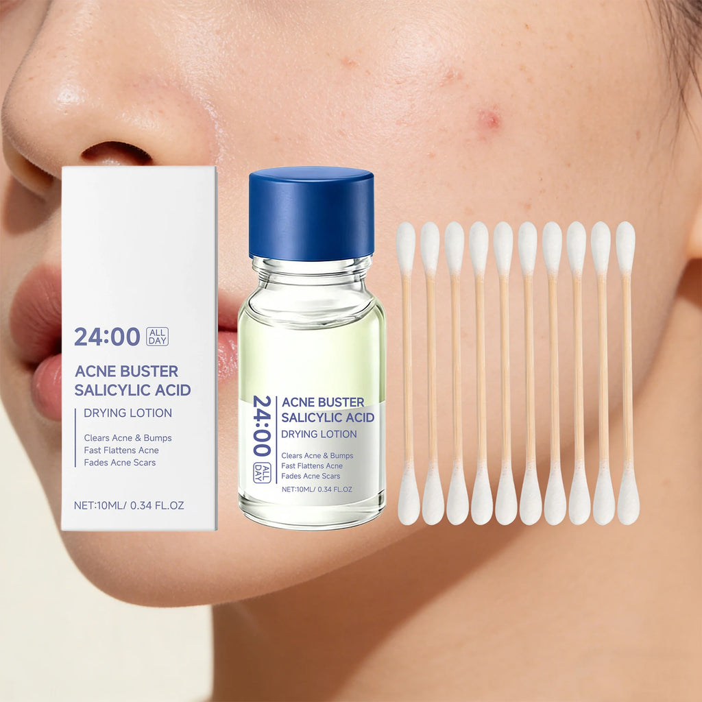 Salicylic Acid Acne Drying Lotion Pimple Remover Serum Fade Marks Shrink Pores Oil Control Face Care with Swabs